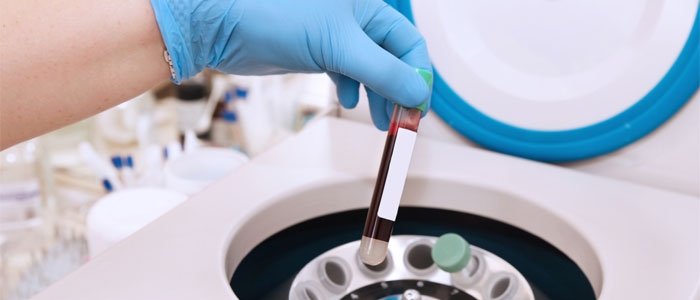 blood sample and centrifuge
